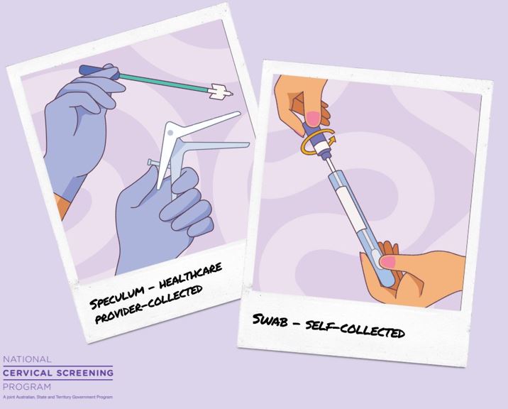 Animation of types of collection methods for cervical screening